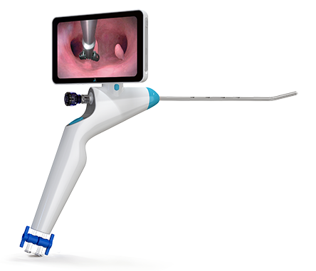 Electronic Hysteroscopic Imaging Catheter & Portable Electronic Endoscope Image Processor