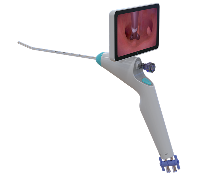Electronic Hysteroscopic Imaging Catheter & Portable Electronic Endoscope Image Processor