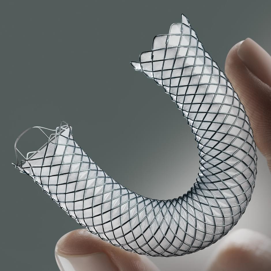 Covered biliary stent